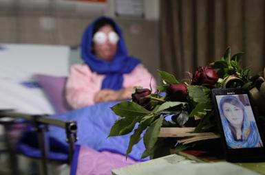 سهیلا جورکش، یکی از آسیب دیدگان حادثه اسیدپاشی اصفهان  که ازناحیه چشم دچار آسیب شدید شده بود